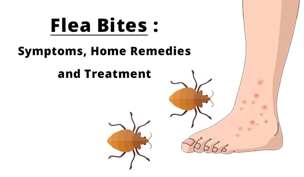 Flea Bites: Symptome, Hausmittel und Behandlung 